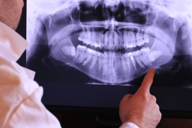 Best Emergency Care for Gum Disease in Hudsonville, MI